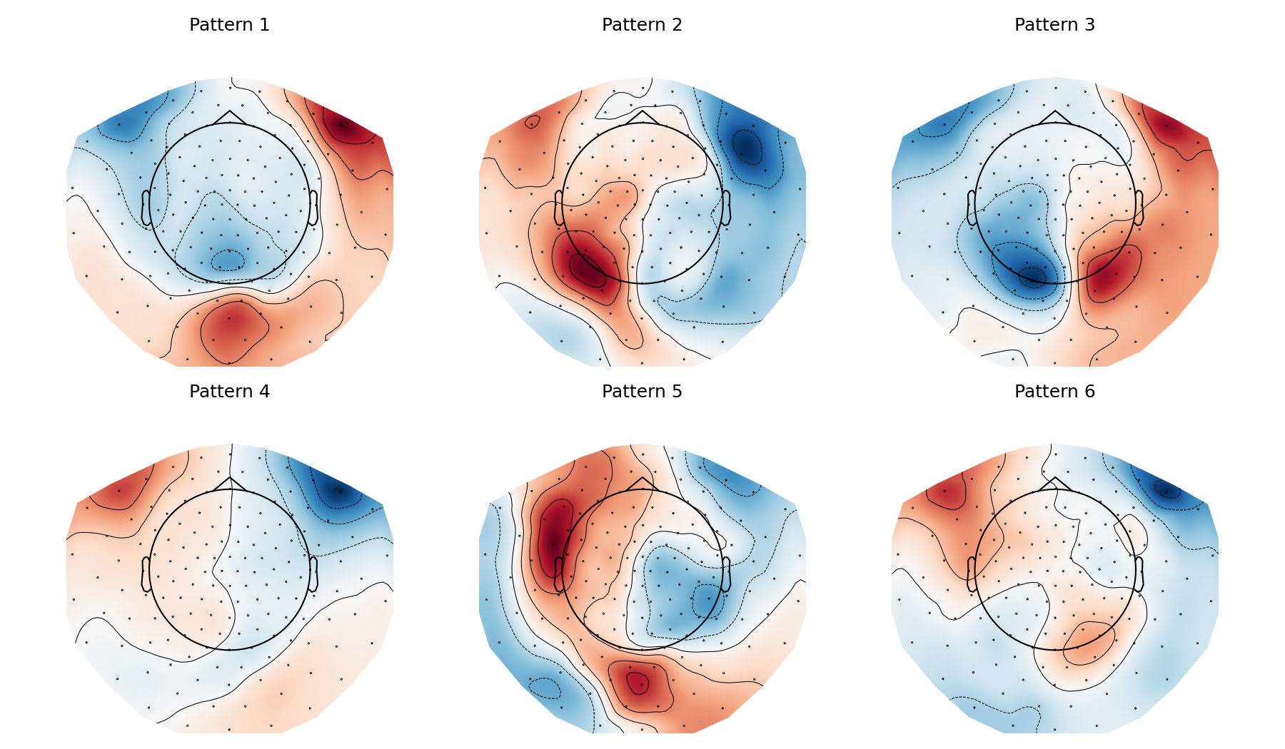 Neuro case figure 2